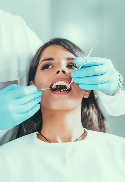 Crowns for Teeth
