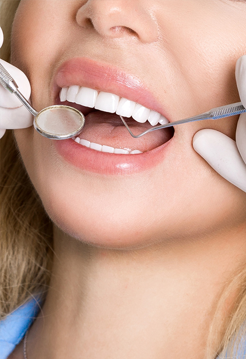 Natural Looking Veneers