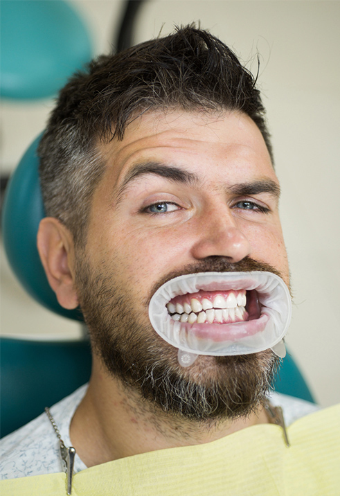 Professional Teeth Whitening